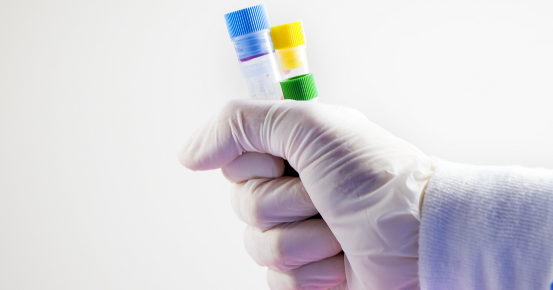 How to Prepare for a Lab Test? A Step-by-Step Guide healthcare nt sickcare