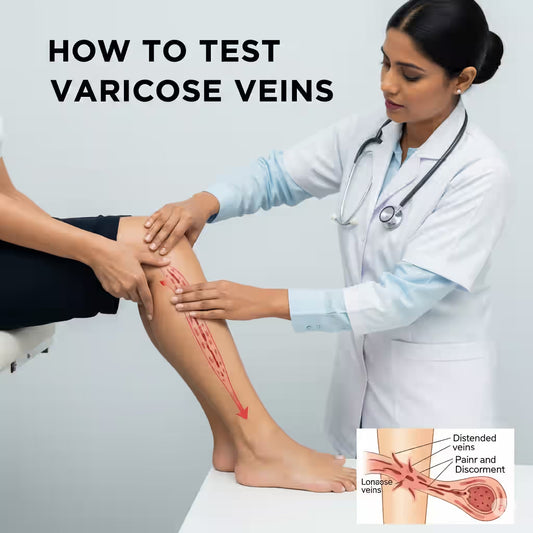 How to Test for Varicose Veins? - healthcare nt sickcare