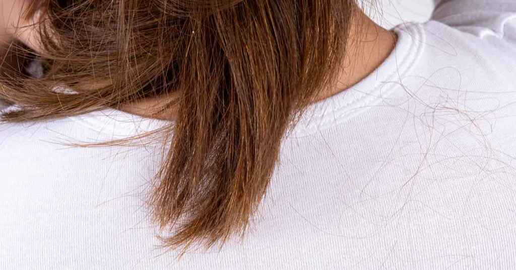 Understanding Hair Fall Causes, Prevention, and Solutions healthcare nt sickcare
