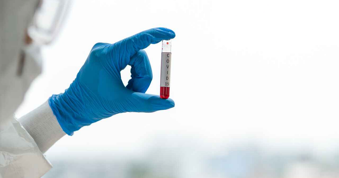 What Happens to Your Blood Sample Once It's Been Collected