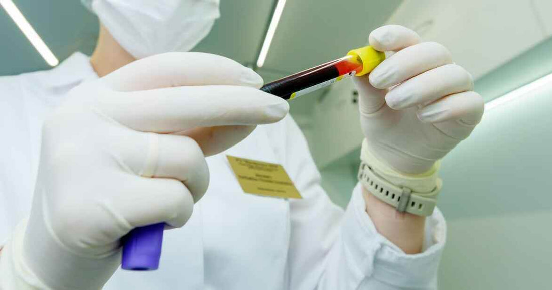 Why Do We Need a Blood Test? - healthcare nt sickcare