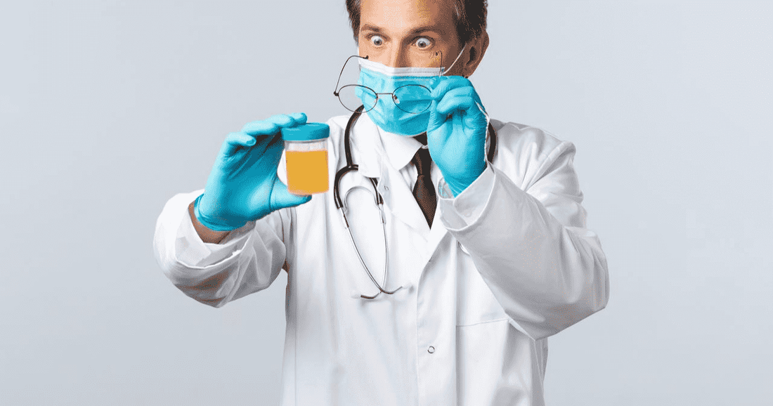 How to Check Pus Cells in Urine? - healthcare nt sickcare