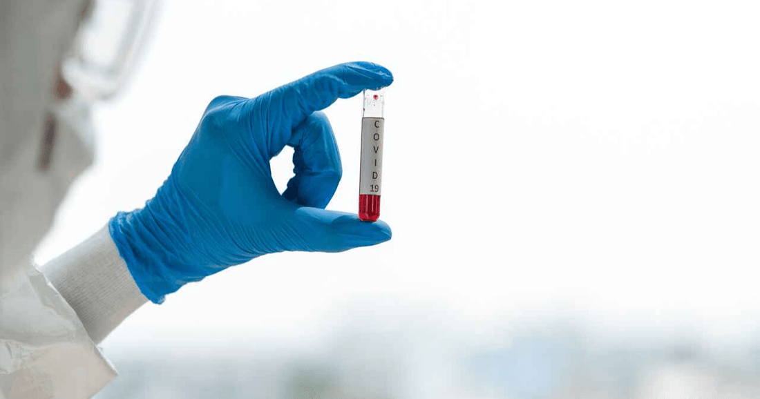 What Happens to Your Blood Sample Once it's Been Collected? - healthcare nt sickcare