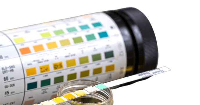 Urinary Tests - healthcare nt sickcare