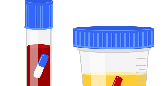 Urine Testing Lab - healthcare nt sickcare