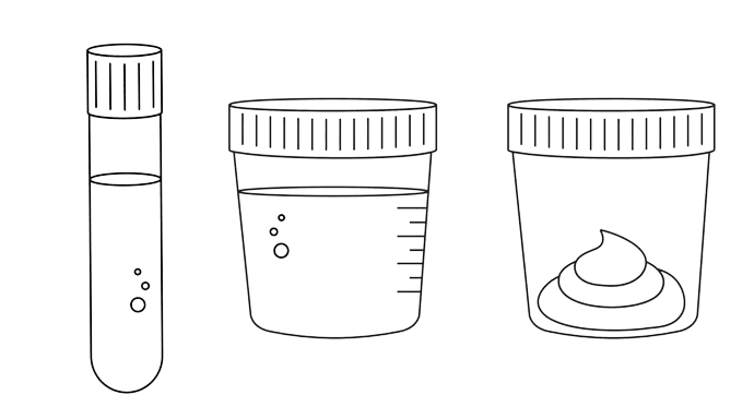 Urine Tests Lab - healthcare nt sickcare