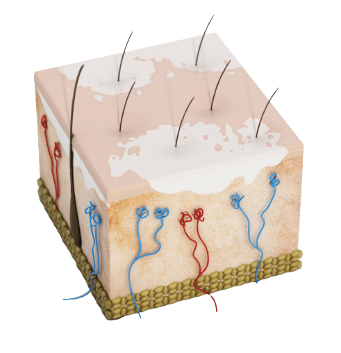 Autoimmune Test Profile - healthcare nt sickcare