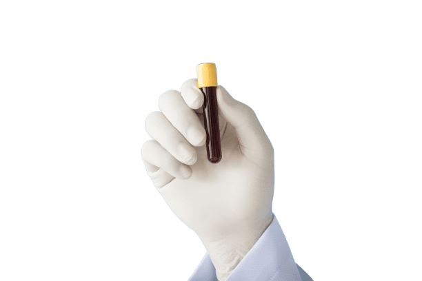 Beta Thalassemia Screening Test - healthcare nt sickcare