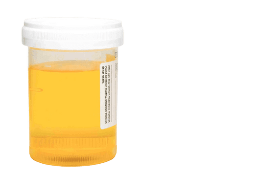 Bile Pigment Test - healthcare nt sickcare