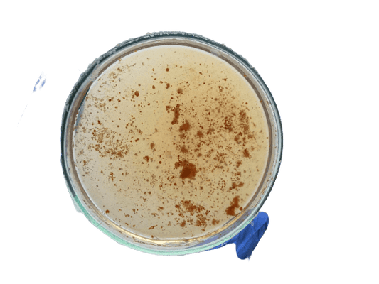 Brucella IgG Test - healthcare nt sickcare