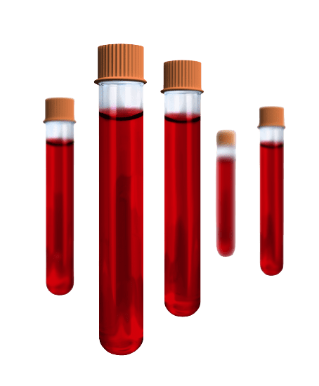 Culture and Sensitivity Aerobic (Blood) Test - healthcare nt sickcare