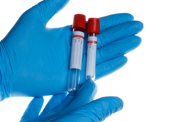 Fibrinogen Test - healthcare nt sickcare