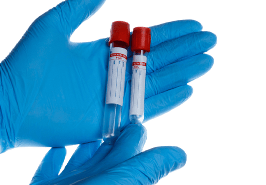 Fibrinogen Test - healthcare nt sickcare