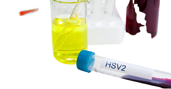 Herpes Simplex Virus (HSV) 1 and 1 PCR Test - healthcare nt sickcare