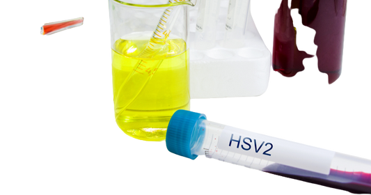 Herpes Simplex Virus (HSV) 1 and 1 PCR Test - healthcare nt sickcare