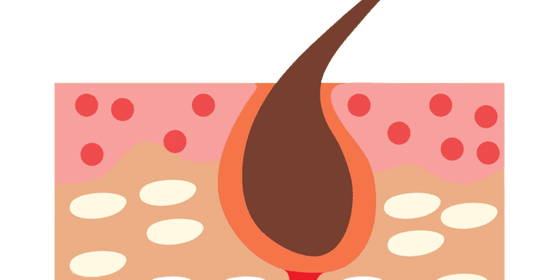 IGFBP-3 Test (IGF Binding Protein-3) - healthcare nt sickcare