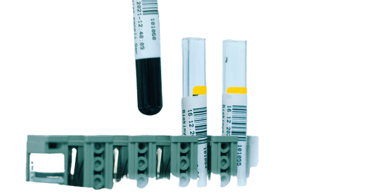 Immature Platelet Fraction Test (IPF) - healthcare nt sickcare