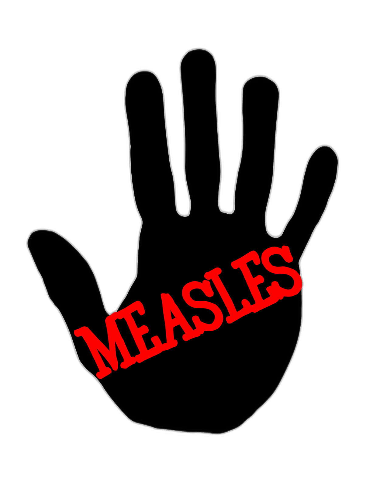 Measles (Rubeola) IgG Test - healthcare nt sickcare