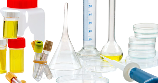 Protein Electrophoresis Urine 24 Hour Test - healthcare nt sickcare