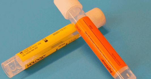 24 Hour Urine Cortisol Test