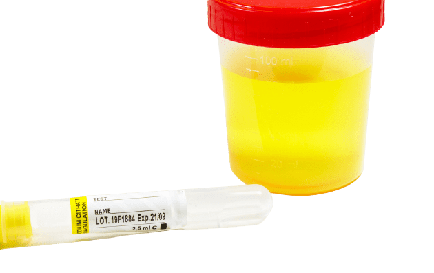 Urea Urine 24 Hour - healthcare nt sickcare