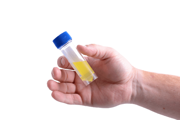 Urinary Urea Spot Test - healthcare nt sickcare