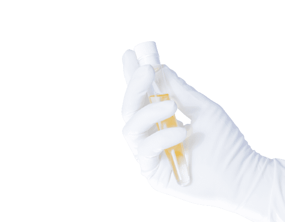Urine Creatinine Test - healthcare nt sickcare